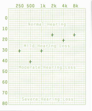 2015-04-16 20_08_06-Online Hearing Test & Audiogram _ Unbiased & Free.png