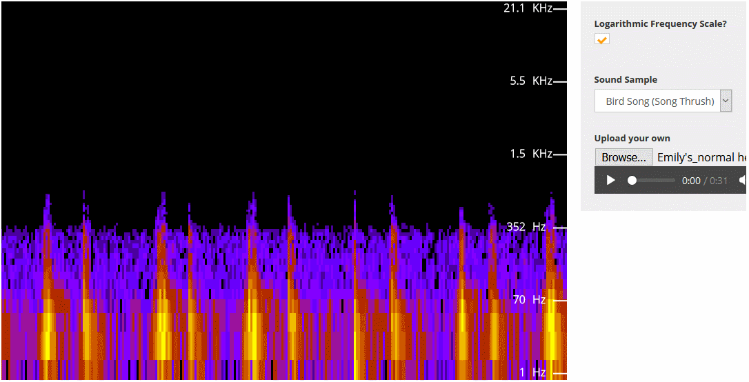 Emily's normal heartbeat spectra.gif