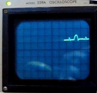 Scope 2.jpg