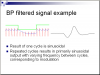 bp_filtered_signal.PNG