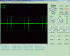 Cardiofrequencemetre_200ms.gif