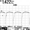 Base TR3 with Trigger by func generator.jpg