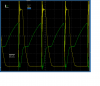 2 ohms.PNG