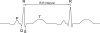 ecg..png