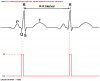 ecg_2..PNG