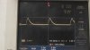 Amplitude of Node Of R39 and C9.jpg