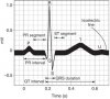 normal+ecg.jpg