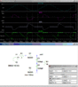 Voltage Doubler.gif