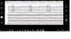 Class-E Converter Waveforms with IPZ65R019C7 MOSFET.png