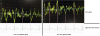 stethoscope signals.png