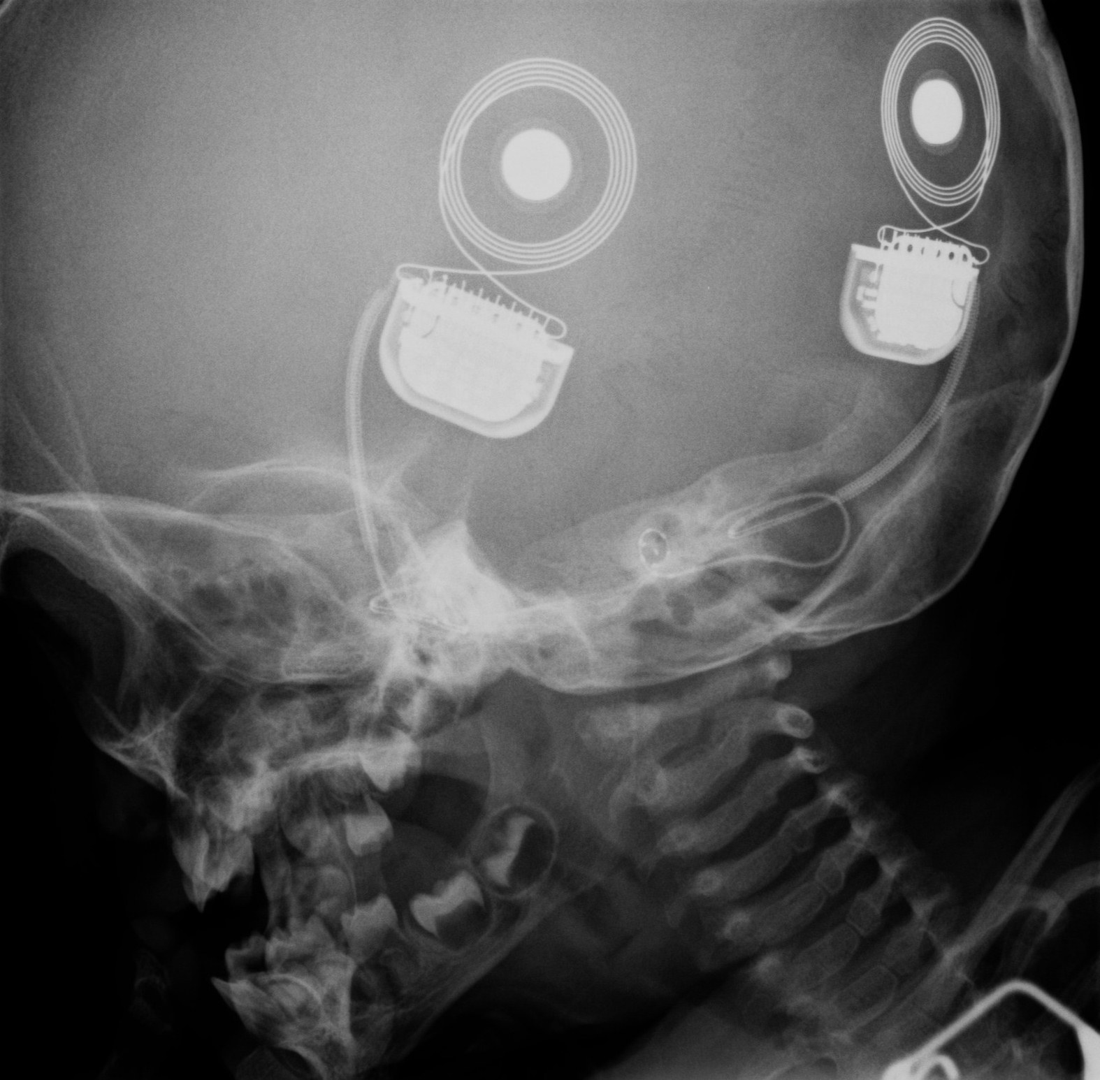 xray.jpg